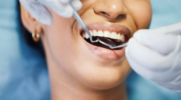 Best Emergency Dental Services for Seniors in Prineville, OR